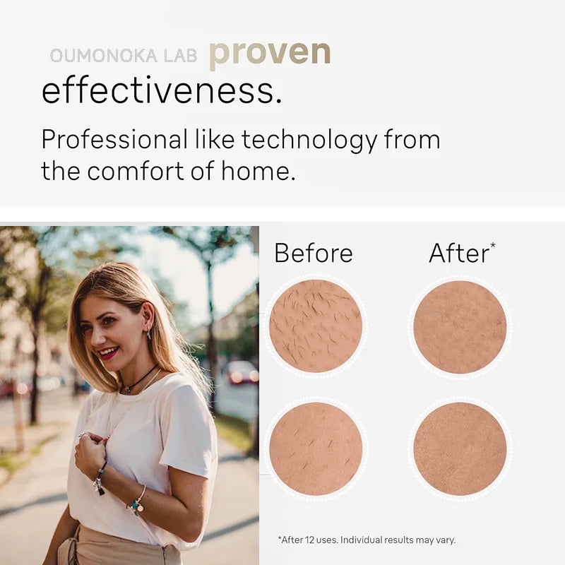 Depiladora láser de cuerpo y bikini con 999.999 pulsos de luz, depiladora láser permanente indolora para mujeres, dispositivos de depilación para uso doméstico.